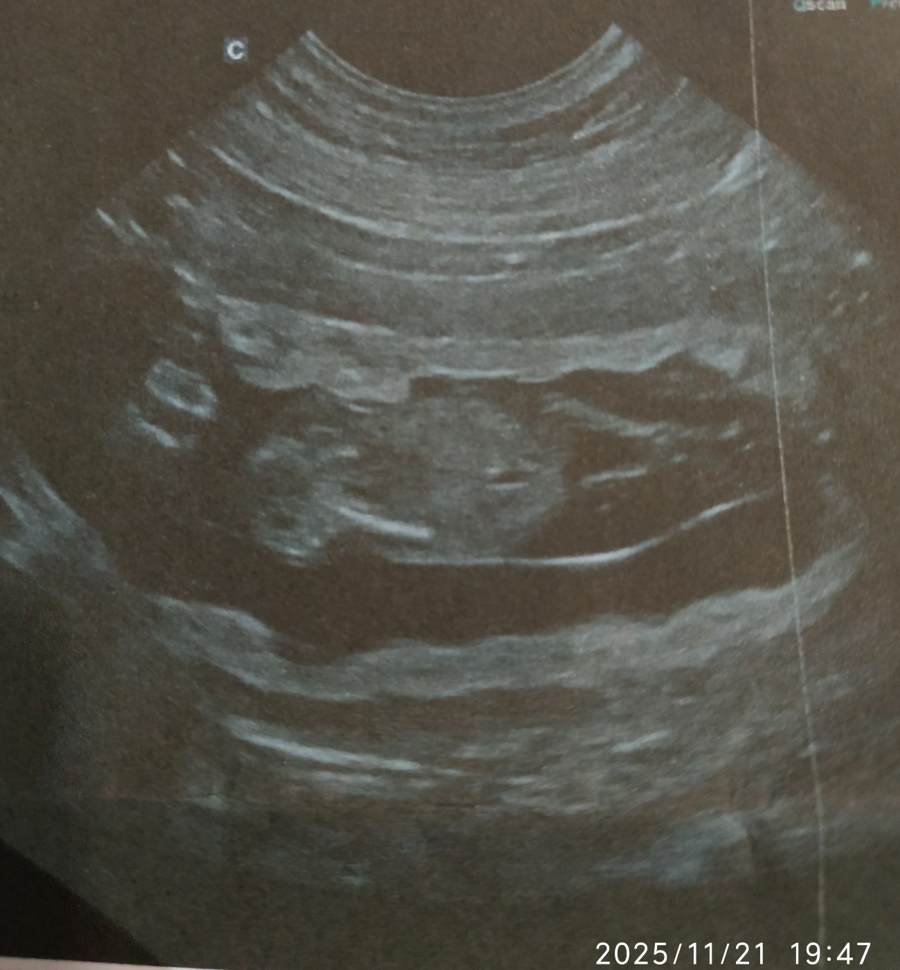 Gestation Confirmée !